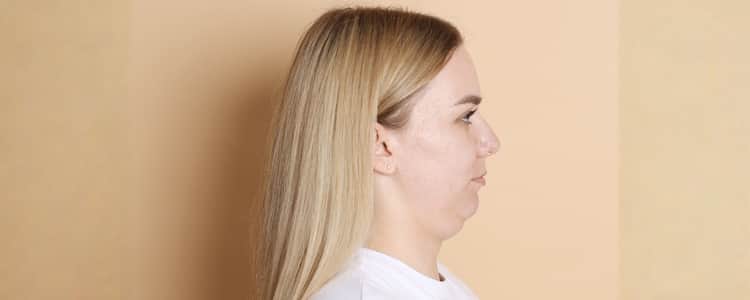 Lump Under the Chin: When Should You Be Concerned?
