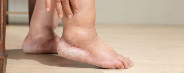 Swollen Legs After Sitting All Day? Here’s What It Means