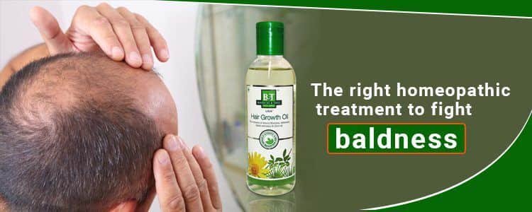 Featured image for the-right-homeopathic-treatment-to-fight-baldness