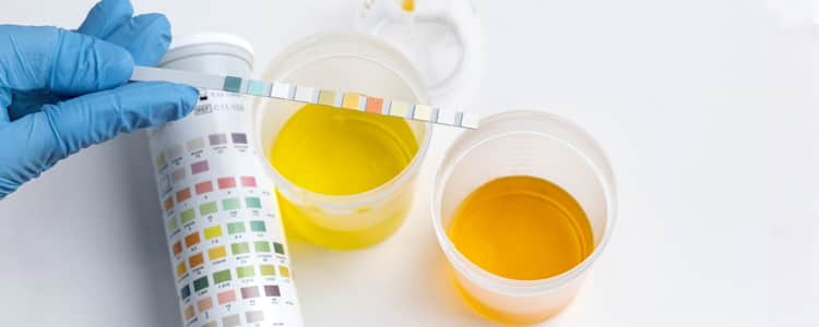 Urine Color Chart: What Each Shade Means for Your Health