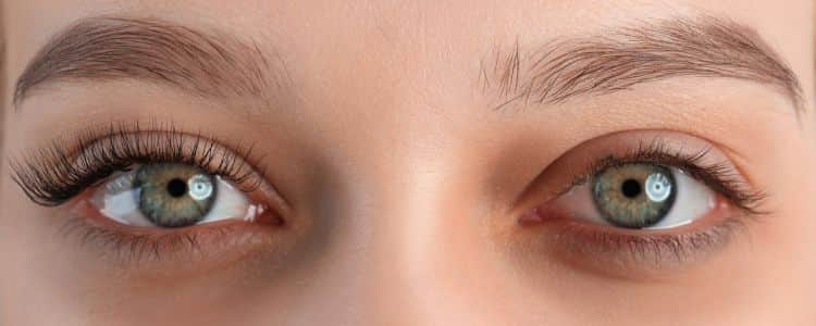 What Causes Dark Circles Under Eyes & How to Fix Them