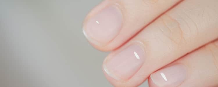 White Spots on Nails: Causes, Symptoms, and What They Really Mean