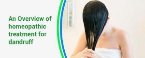 overview-of-homeopathic-treatment-for-dandruff